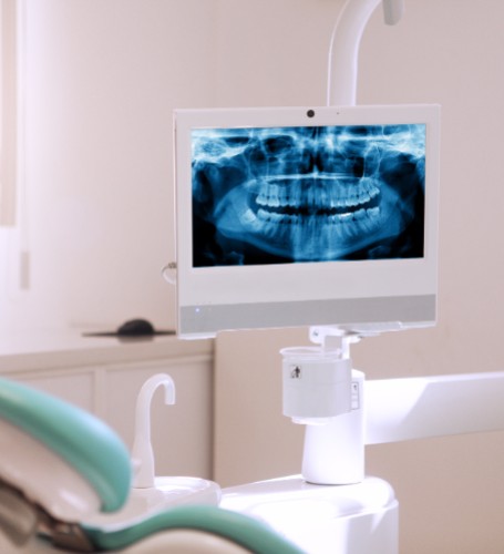 Digital dental X-Rays, Delta Dentist